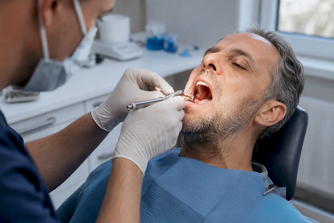 Roke zobozdravnika med postopkom vstavljanja implantata, posnetek od blizu