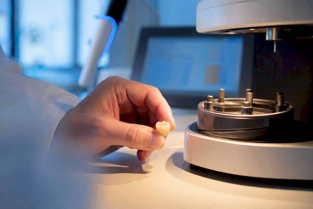 Izdelava začasne akrilne krone v zobotehničnem laboratoriju