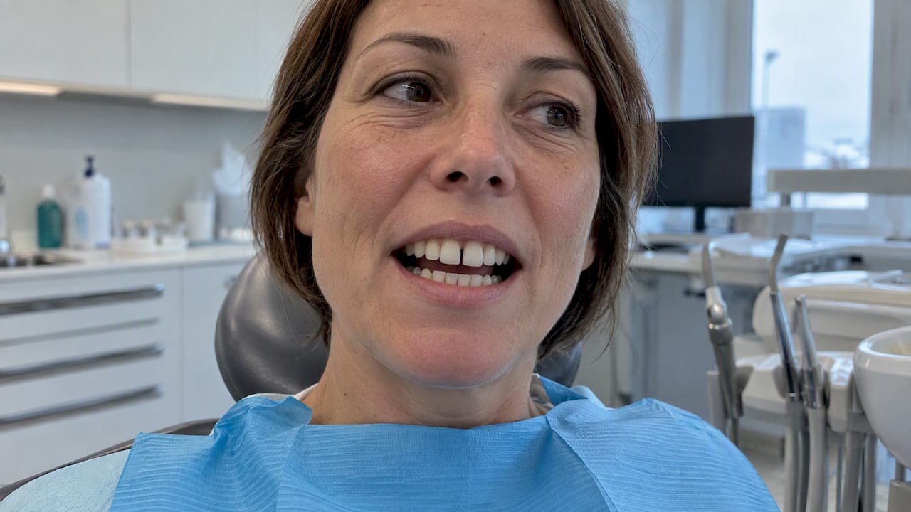 Odpiranje temnega prostora med sprednjima zoboma